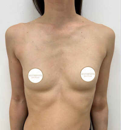 mia-femtech-005-pred