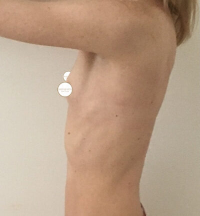 mia-femtech-015-pred