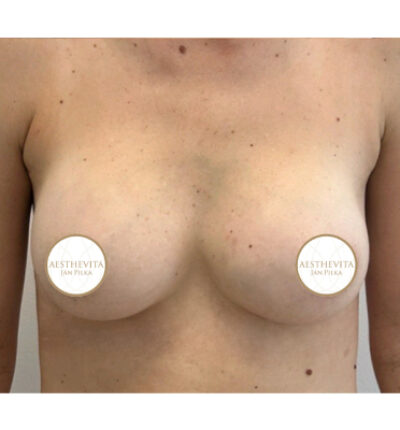 mia-femtech-012-po-1