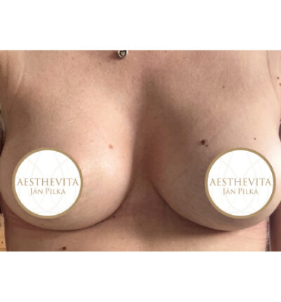 mia-femtech-023-po-1