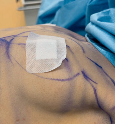 mia-femtech-029-pred