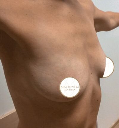 mia-femtech-031-pred