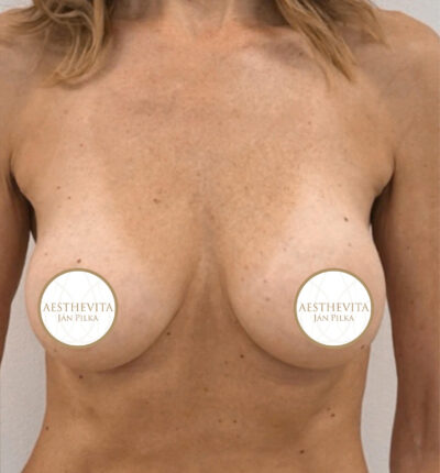 mia-femtech-036-po-1