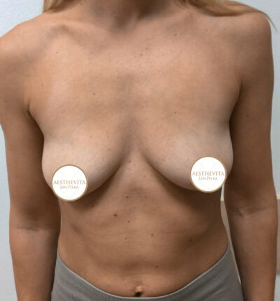 mia-femtech-049-pred