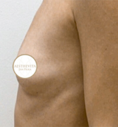 mia-femtech-060-pred