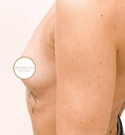 mia-femtech-061-pred