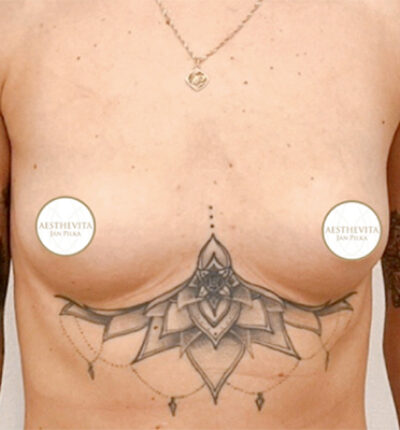 mia-femtech-063-pred